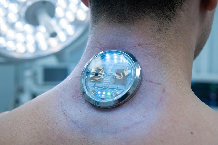 Stack Corticali: Il Corpo come Proprietà Sostituibile